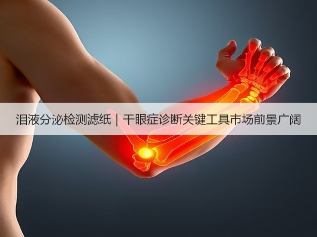 泪液分泌检测滤纸｜干眼症诊断关键工具市场前景广阔(图2)