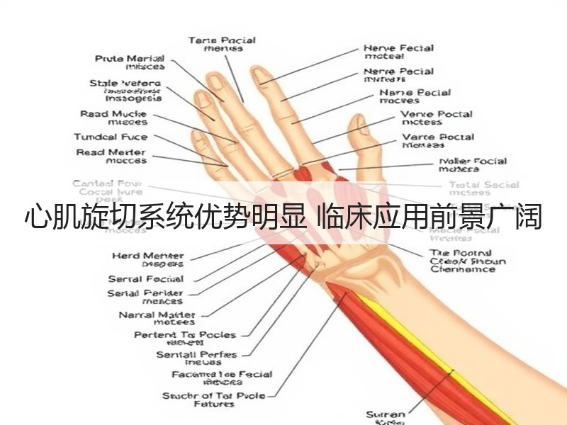 心肌旋切系统优势明显 临床应用前景广阔