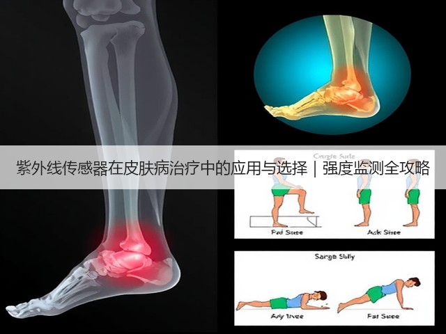 紫外线传感器在皮肤病治疗中的应用与选择|强度监测全攻略(图1) 紫外线传感器在皮肤病治疗中的应用与选择|强度监测全攻略(图1)