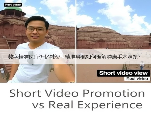 数字精准医疗近亿融资,精准导航如何破解肿瘤手术难题?(图3) 数字精准医疗近亿融资,精准导航如何破解肿瘤手术难题?(图3)