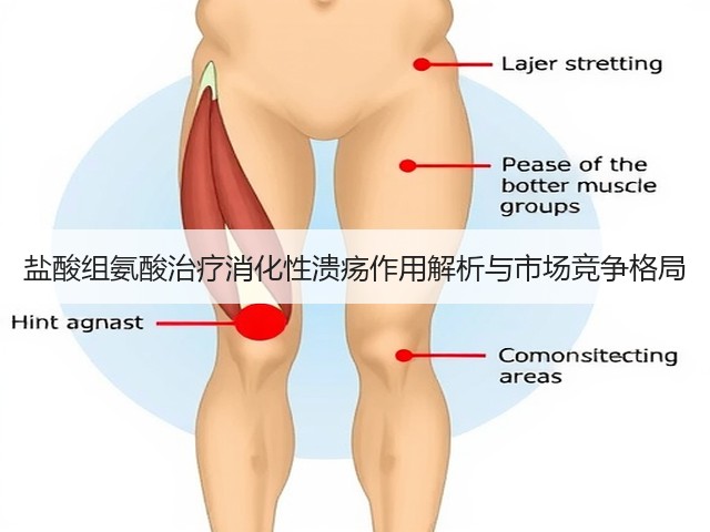 盐酸组氨酸治疗消化性溃疡作用解析与市场竞争格局(图1) 盐酸组氨酸治疗消化性溃疡作用解析与市场竞争格局(图1)