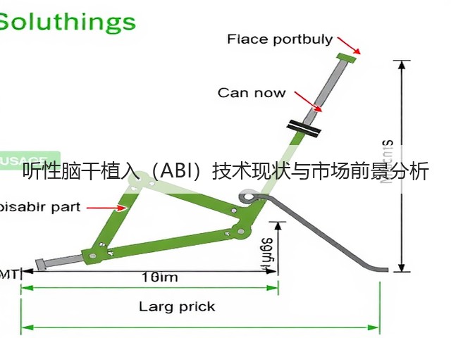 听性脑干植入(ABI)技术现状与市场前景分析(图1) 听性脑干植入(ABI)技术现状与市场前景分析(图1)