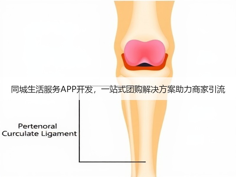 同城生活服务APP开发，一站式团购解决方案助力商家引流