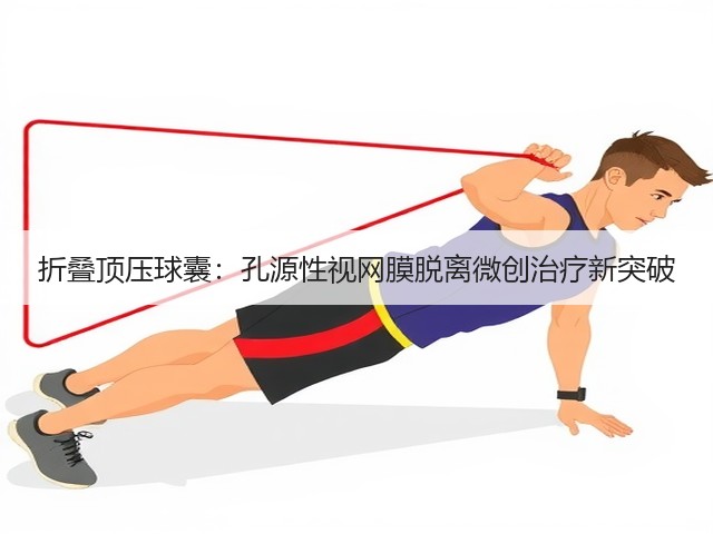 折叠顶压球囊:孔源性视网膜脱离微创治疗新突破(图3) 折叠顶压球囊:孔源性视网膜脱离微创治疗新突破(图3)